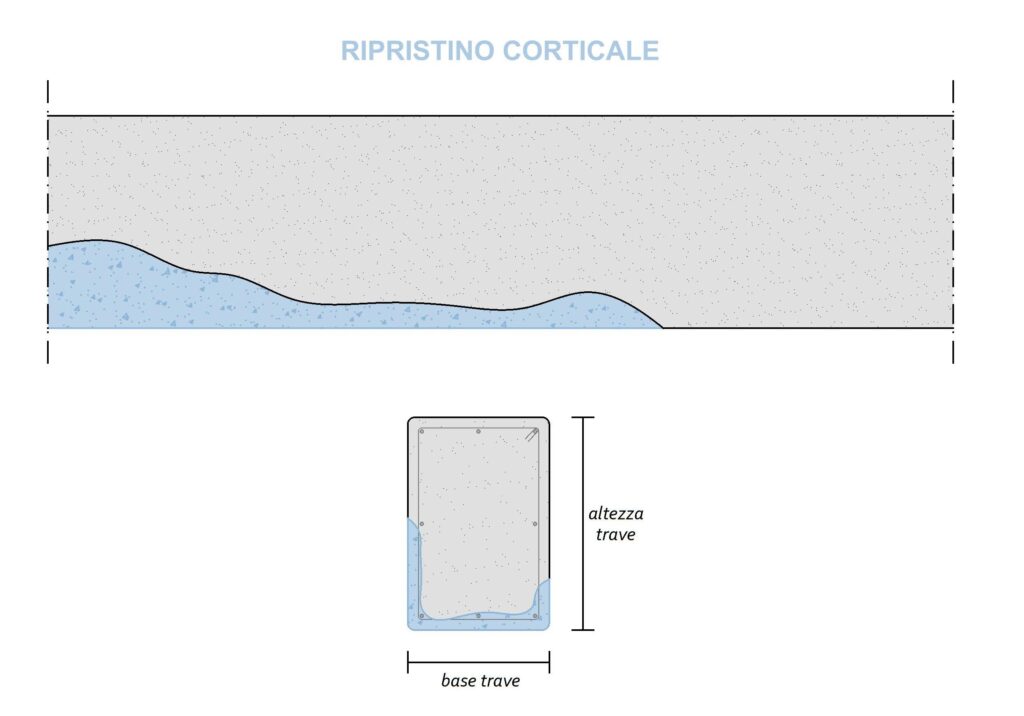 Ripristino corticale